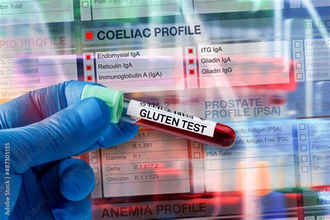 coeliac serology blood test bottle|coeliac screen interpretation.